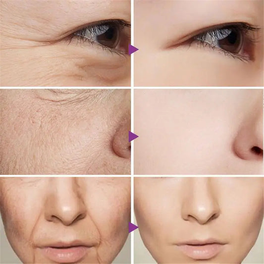 Instant Remove Wrinkles Face Cream Anti Aging Korean Cream Moisturizing Fades Fine Lines Lifting Firming Whitening Brighten Skin