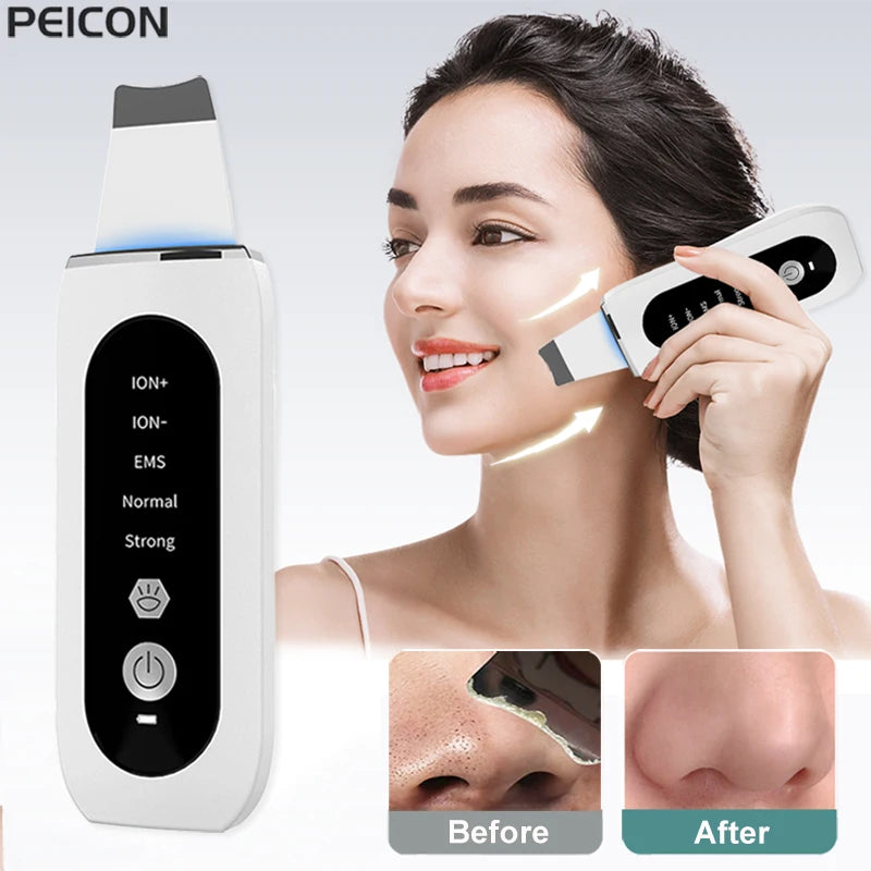 Ultrasonic Skin Scrubber Peeling Blackhead Remover Deep Face Cleaning Ultrasonic Ion Ance Pore Cleaner Facial Shovel Cleanser