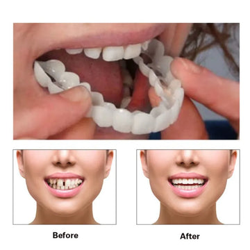 Perfect Fit Teeth Whitening Fake Tooth Cover Snap On Silicone Smile Veneers Teeth Upper Beauty Tool Cosmetic Teeth Free shipping
