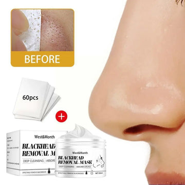 LANBENA Blackhead Remover Nose Face Mask Shrink Pores Mask Strip Care Peeling Dots Black Deep Cleansing Tearing Acne Pore S M8D6