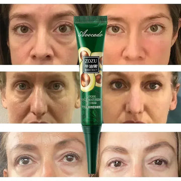 7 Day Tighten Wrinkles Eye Cream Eye Fine Line Whiten Under Eyes Skin Korean Care Anti Dark Circles Bags Puffiness Fade New 2024