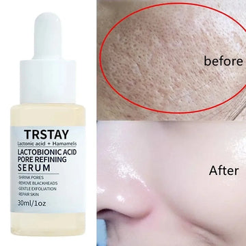 Lactobionic Acid Serum Shrink Pores Moisturizing Essence Liquid Facial Purify Pore Treatment Beauty whitening cream Skin Care