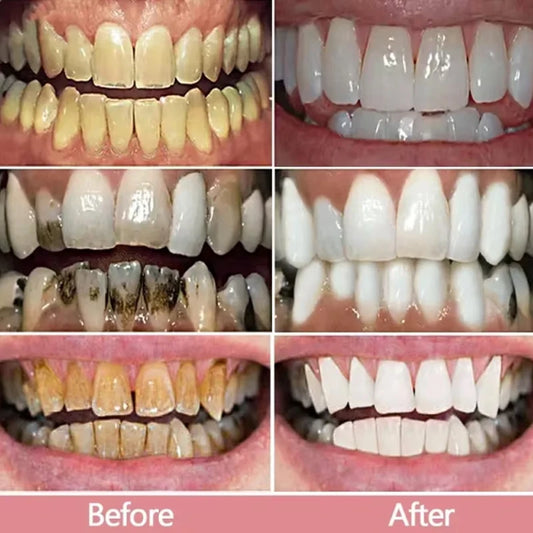 100g Probiotic Toothpaste Lemon Mint Whitening Tooth Remove Plaque Stains Teeth Whitener Oral Hygiene Clean Fresh Breath Dental