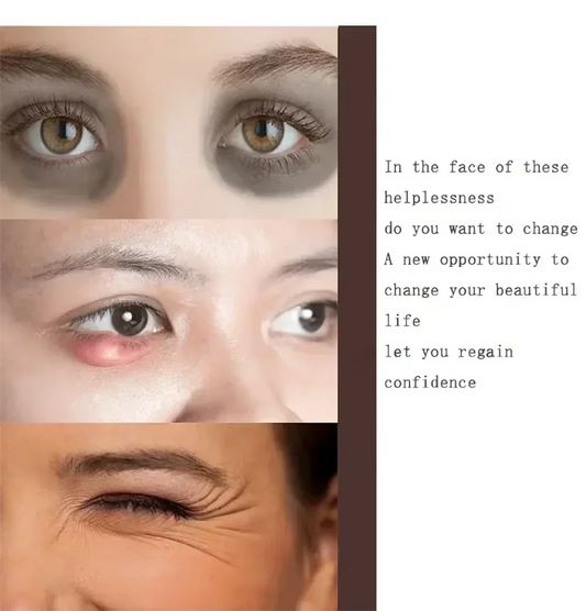 Remove Wrinkles Eye Cream Anti Dark Circles Bags Puffiness Fade Eye Fine Line Tighten Whiten Under Eyes Skin Korean Care