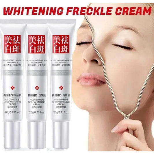 Freckle Whitening Cream Black Dots Melasma Removal Anti Brown Stain Lighten Pigmentation Moisturizing Skin Care Korean Products