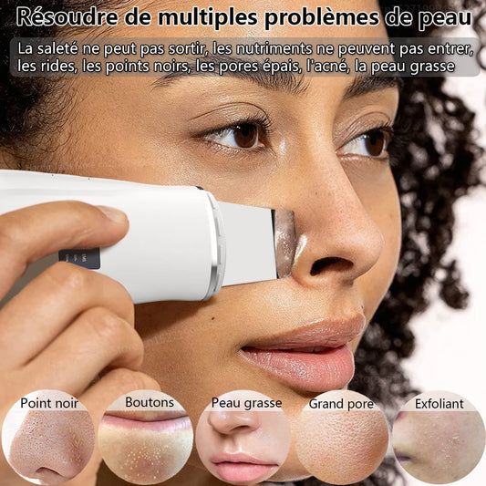 Ultrasonic Peeling Remover Blackhead Facial Skin Scrubber Facial Shovel Deep Cleaning Face Lifting Removal Pore Acne EMS Lift