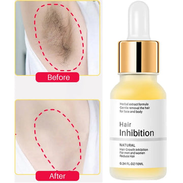 New Permanent Hair Inhibition Woman Serum Painless Hair Powerful Fast Restrain Armpit Legs Arms Hair Growth Inhibitor Depilatory