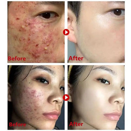 Original 40g Remove Blackhead Green Tea Solid Mask Cleansing Stick Mask Facial Dispel Acne Blemish Shrink Pores Korean Skin Care