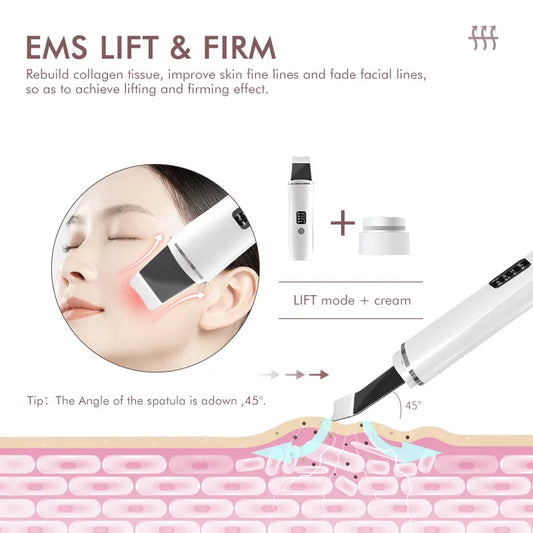 EMS Ultrasonic Skin Scrubber Vibration Facial Spatula Peeling Shovel Ion Acne Blackhead Remover Clean Cavitation Face Massager