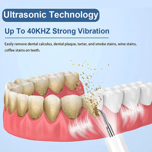 Dental Scaler For Teeth Tartar Remover Electric Teeth Cleaner Tooth Calculus Plaque Remover Ultrasonic Dental Stone Removal