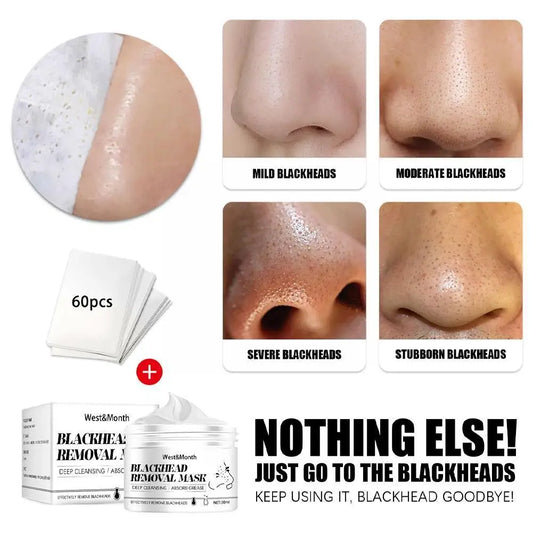 LANBENA Blackhead Remover Nose Face Mask Shrink Pores Mask Strip Care Peeling Dots Black Deep Cleansing Tearing Acne Pore S M8D6