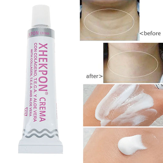 Xhepon Neck Anti-wrinkle Cream Hydrolized Collagen Aloe Vera Anti-aing Cream Reduce Neck Fine Lines Moisturizingn Skin Care 40g